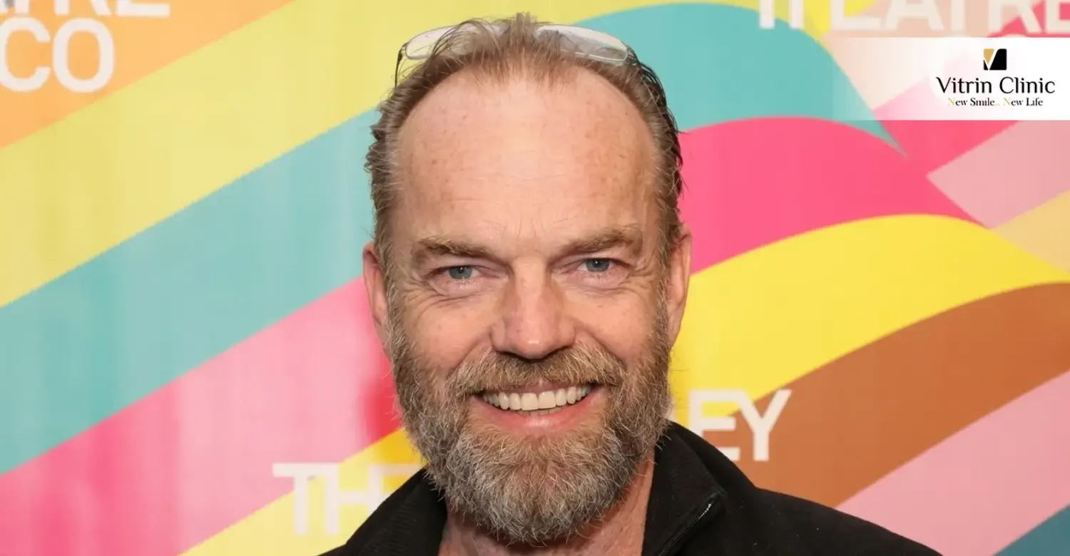 How does Hugo Weaving smile captivate audiences?